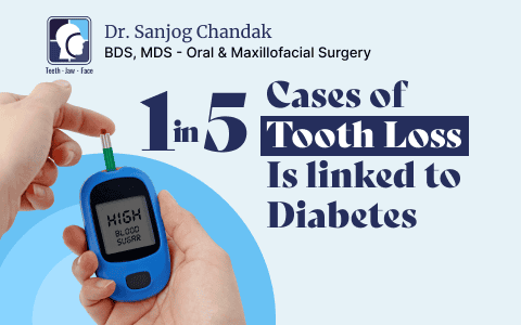 Best Artificial Teeth for Diabetic