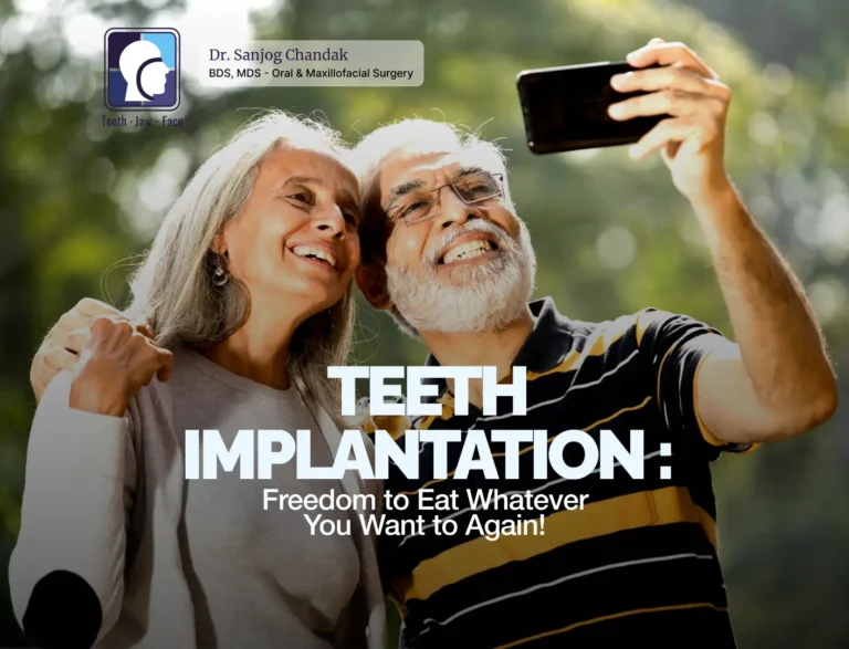 Low cost Dental Implant Nagpur