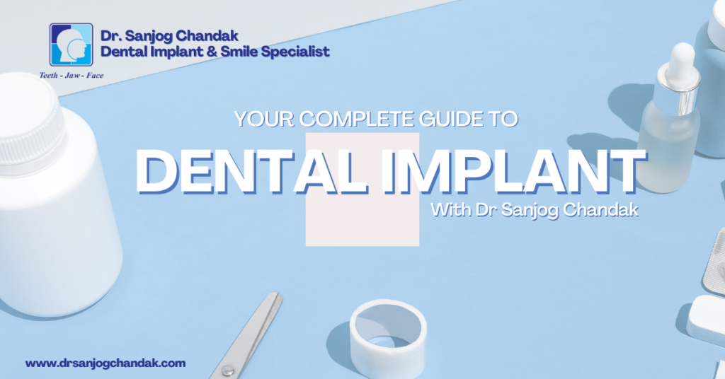 Everything About Dental Implant