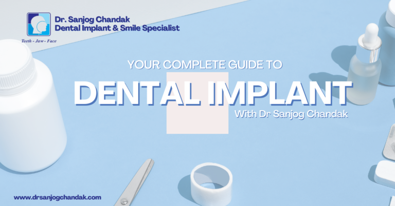 Everything About Dental Implant