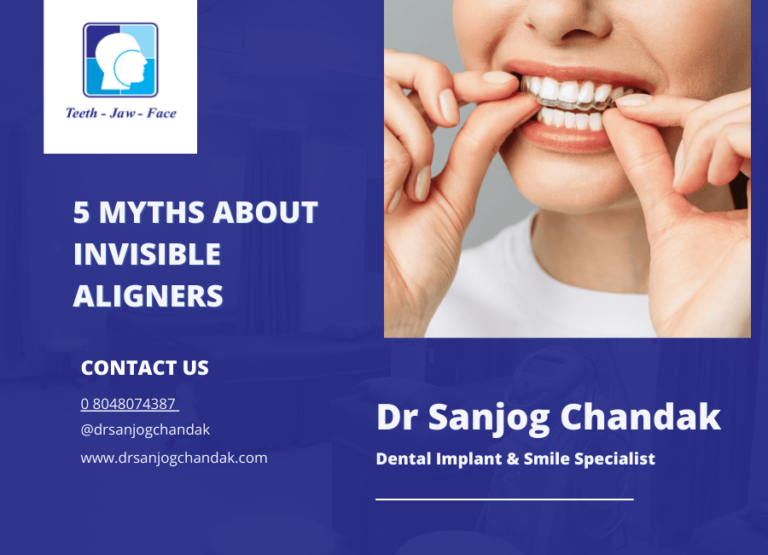 Busting Myths About Teeth Invisible Aligners