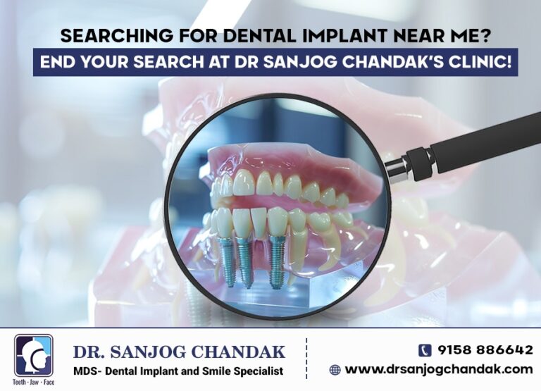 Dental Implant Near Me