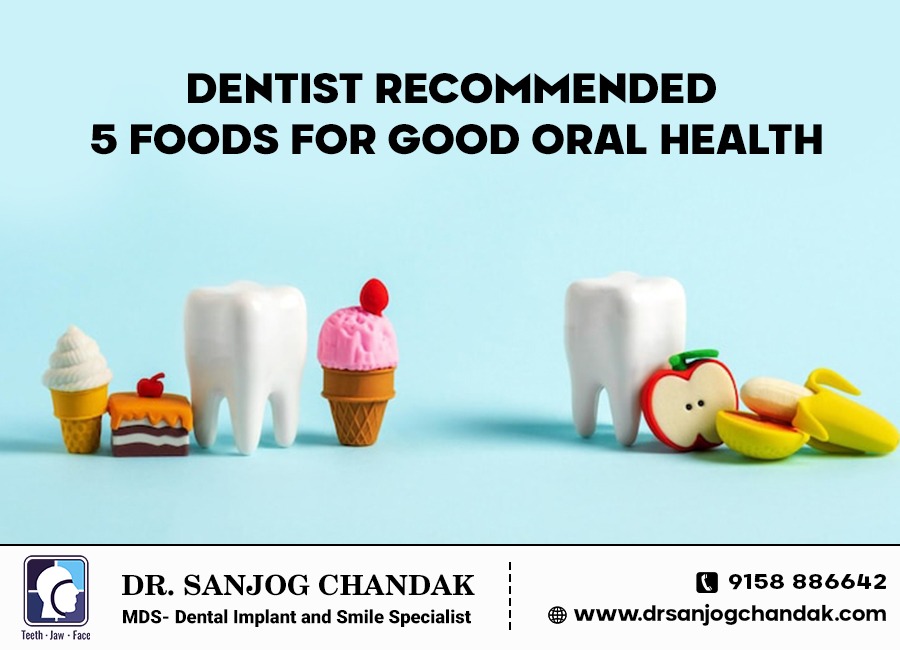 Food to eat for good smile