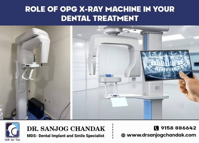 Role Of OPG X-ray Machine In Dental Treatment