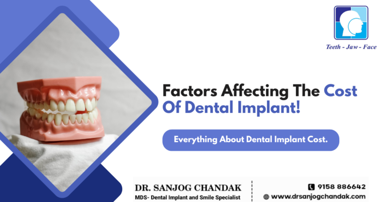 Dental Implant Cost In Nagpur