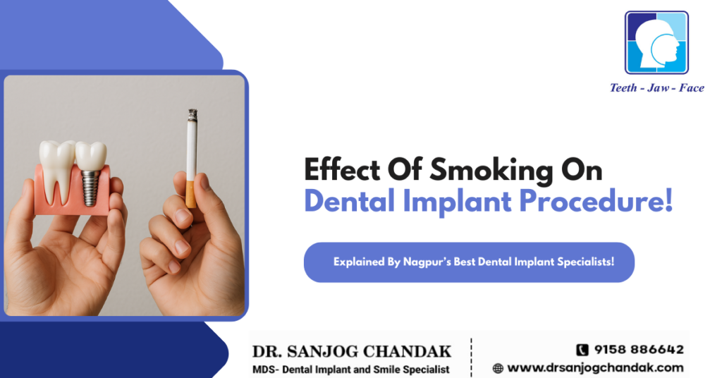 Dental Implant and smoking