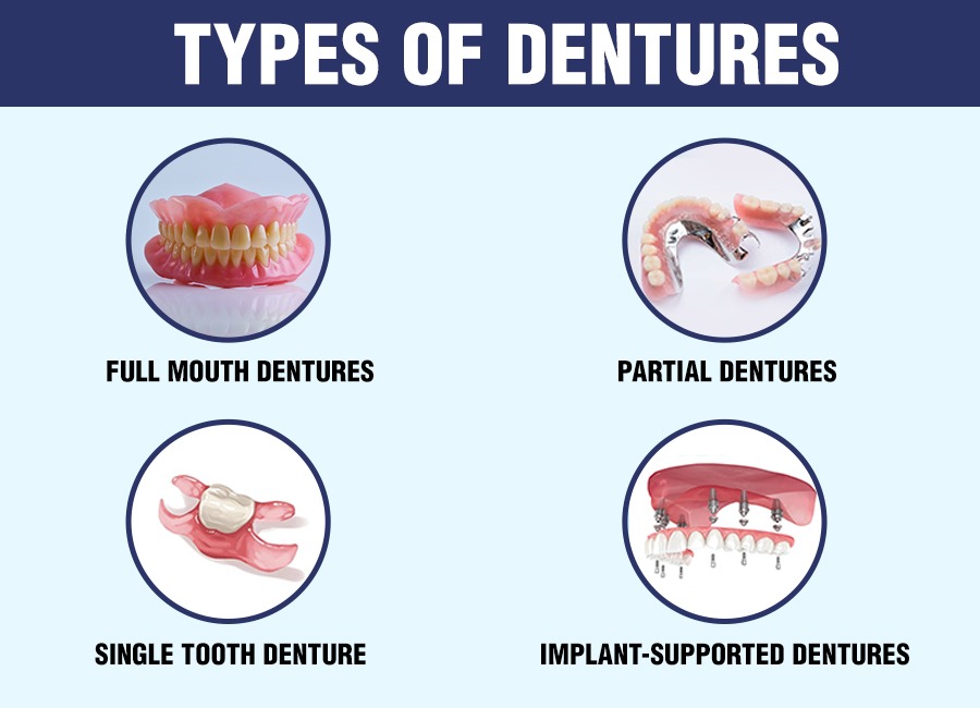 Types Of Dentures