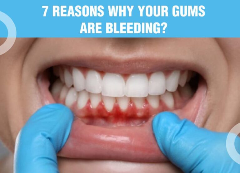 Gum Bleeding Reasons