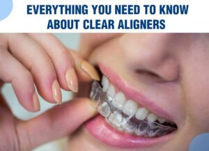 Clear aligners