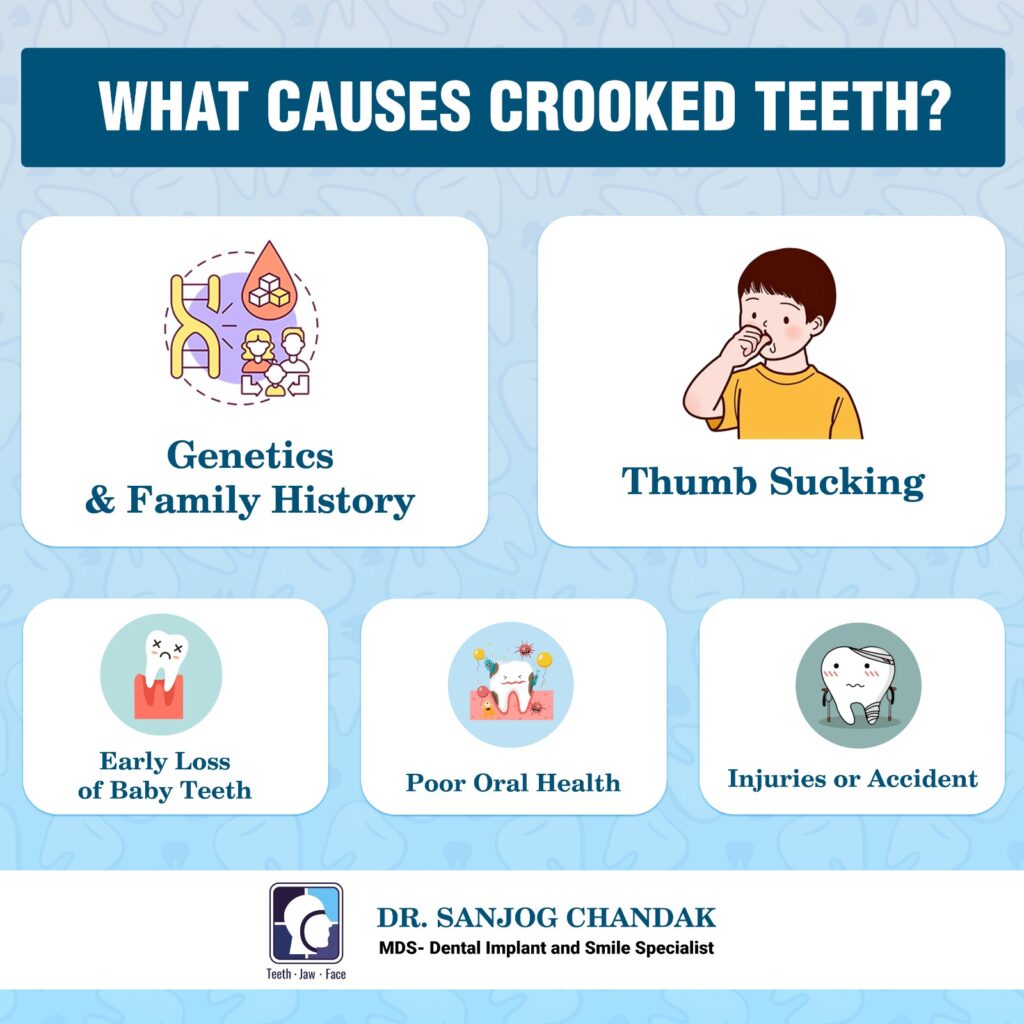 What causes crooked teeth? 