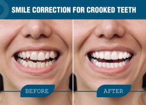 Smile Correction Cost In Nagpur
